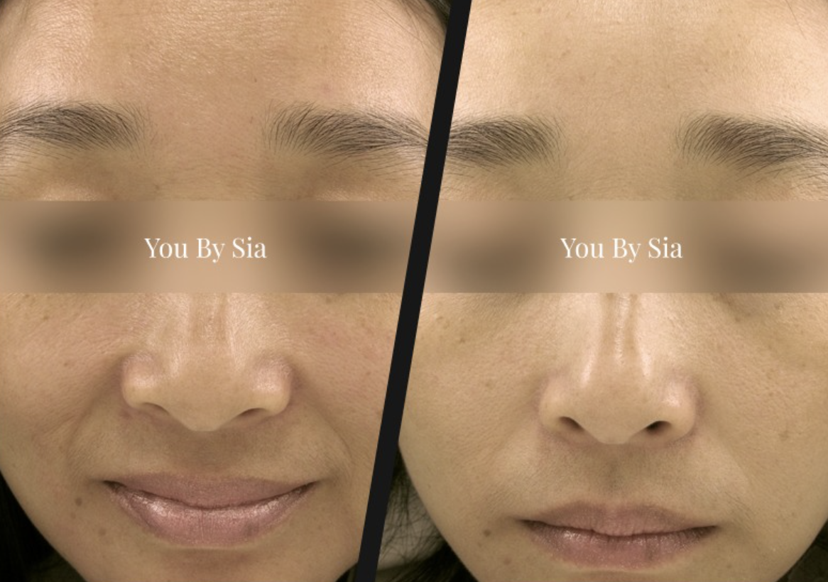 Before and after — You By Sia client