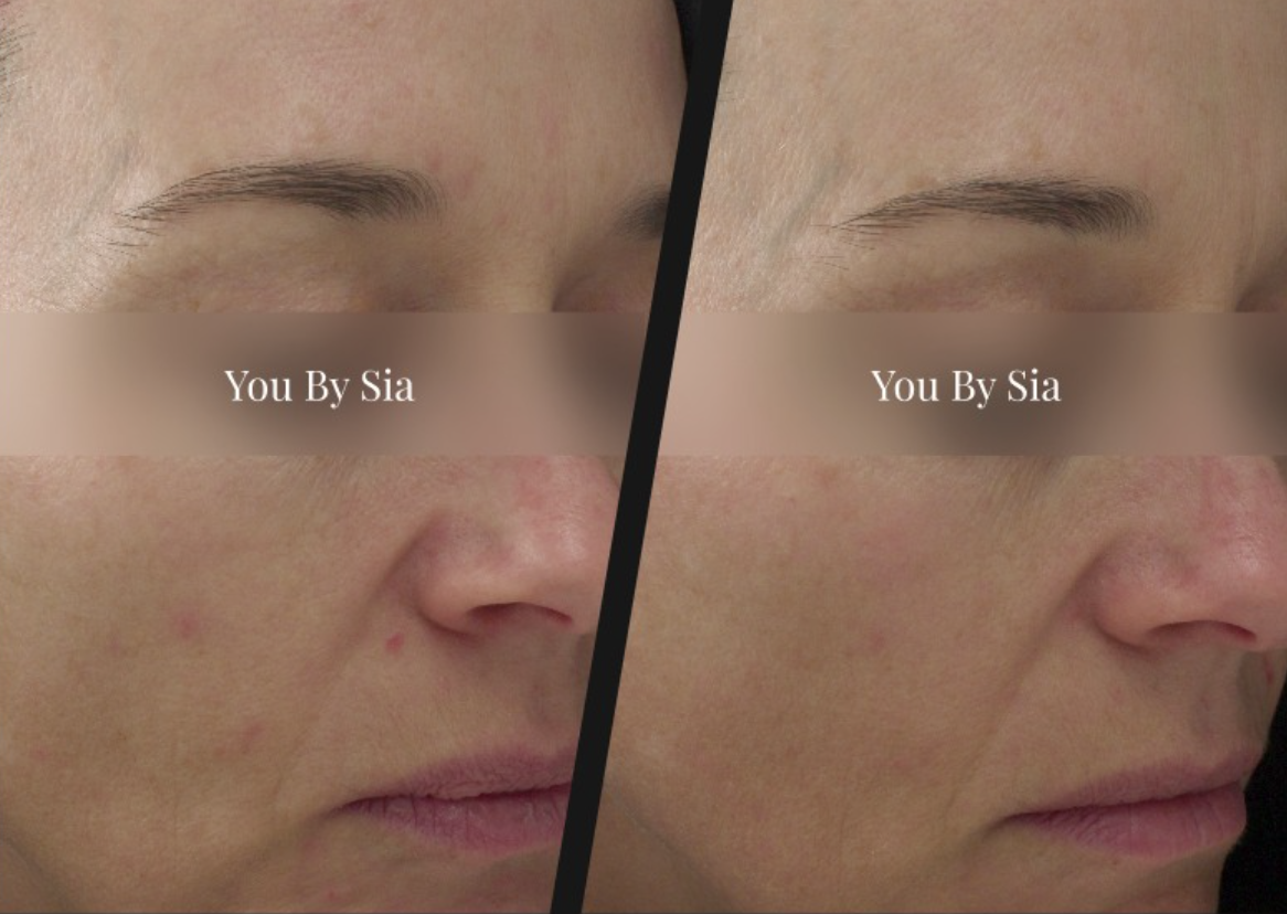 Before and after — You By Sia client